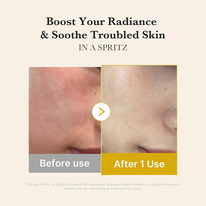 Translation missing: en.Medicube Kojic Acid Turmeric Vita Gelly Mist Serum