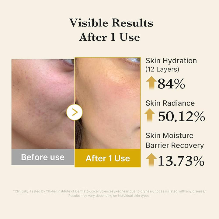 Translation missing: en.Medicube Kojic Acid Turmeric Vita Gelly Mist Serum