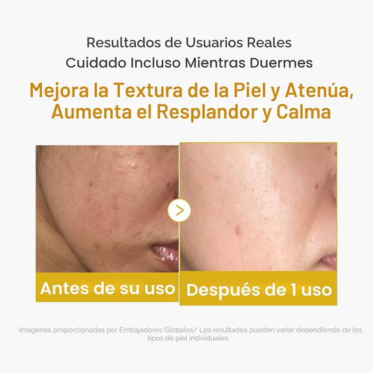 Translation missing: en.Medicube Kojic Acid Turmeric Night Wrapping Mask