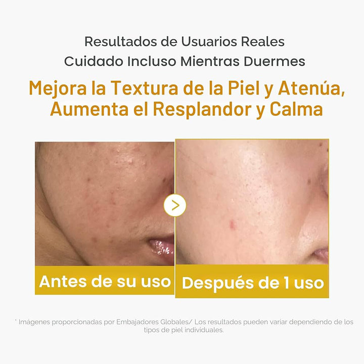 Translation missing: en.Medicube Kojic Acid Turmeric Night Wrapping Mask