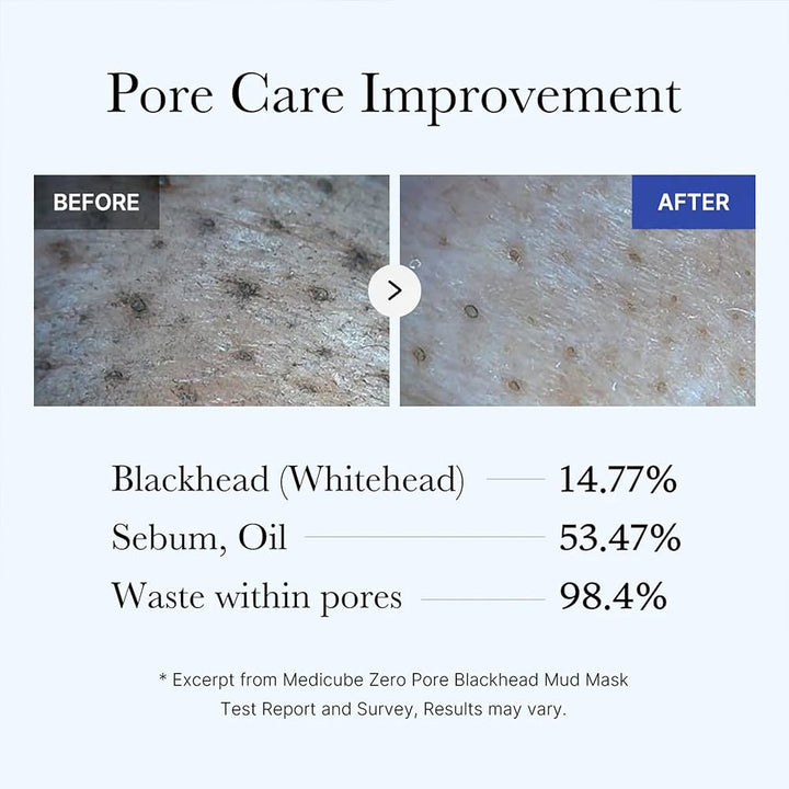 Translation missing: en.Medicube Zero Pore Blackhead Mud Mask