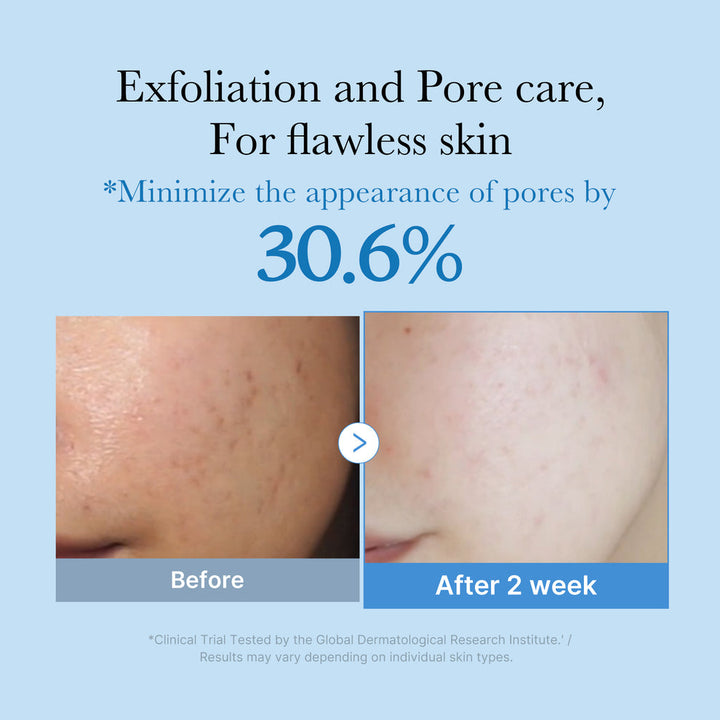 Translation missing: en.Medicube Zero Pore Toner