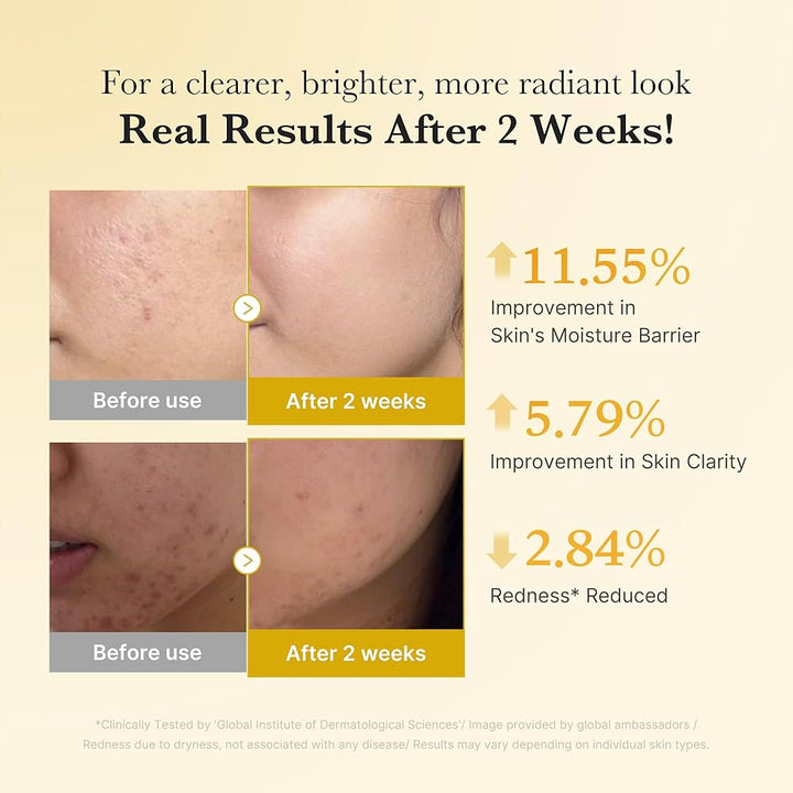 Translation missing: en.Medicube Kojic Acid Turmeric Niacinamide Serum