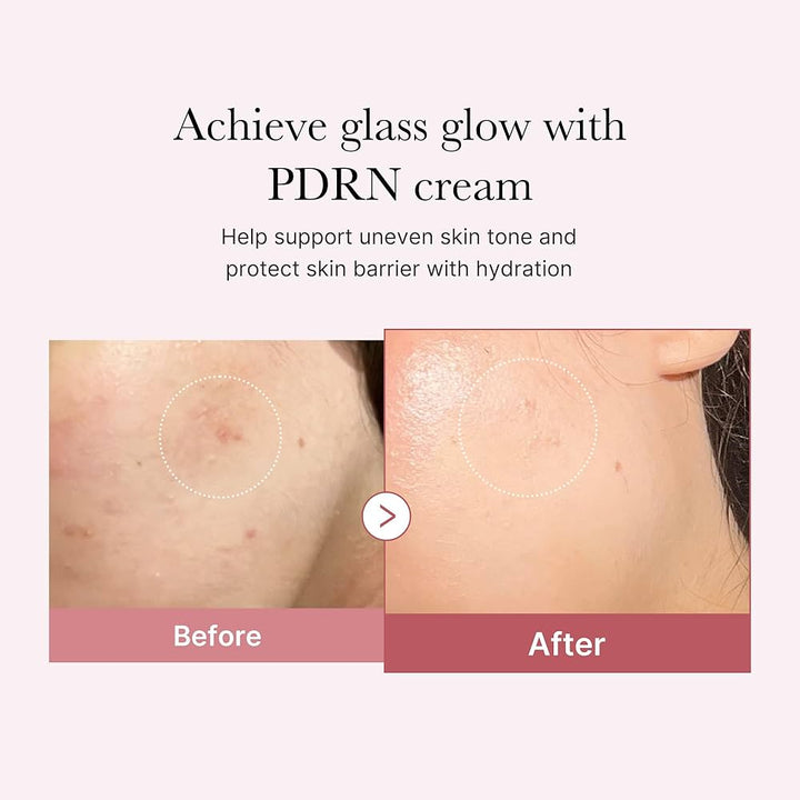 Translation missing: en.Medicube PDRN Pink Hyaluronic Moisturizing Cream