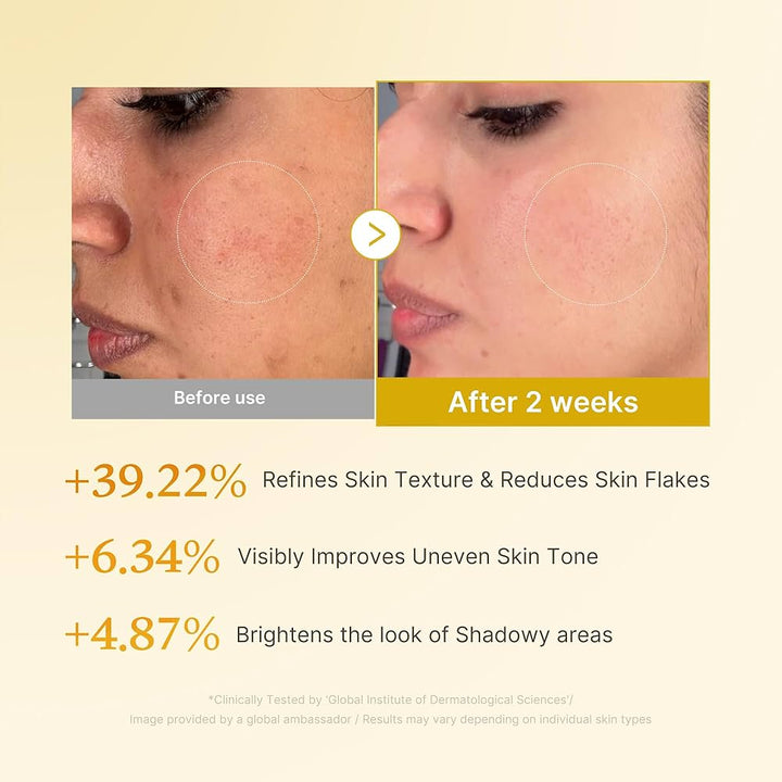 Translation missing: en.Medicube Kojic Acid Turmeric Resurfacing Toner