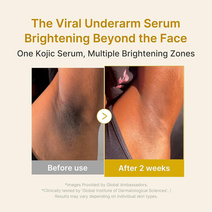 Translation missing: en.Medicube Kojic Acid Turmeric Niacinamide Serum